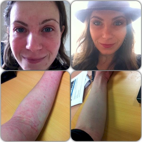 images of my skin when i was 21